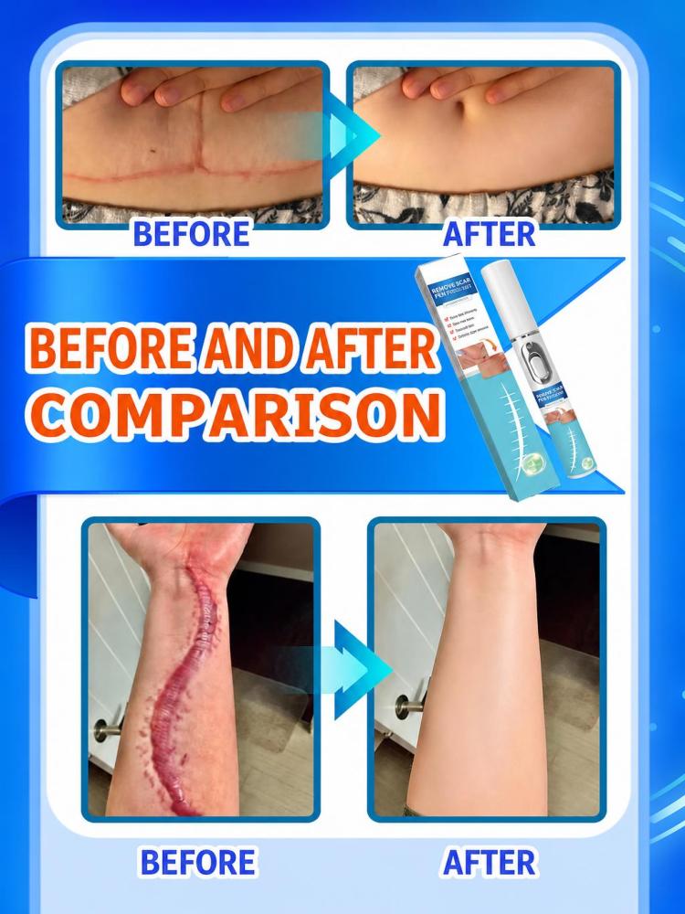 Mini Handheld Skin Surface Car - Home Improvement Mark ulasan dan harga