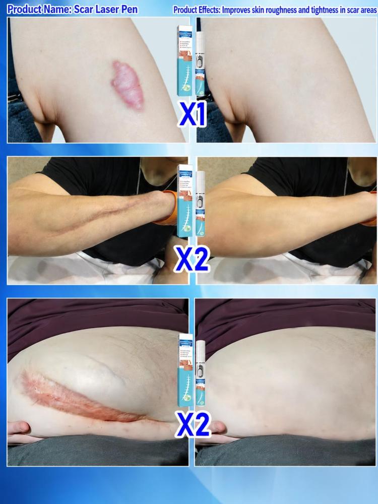 Handheld Skin Beauty Care Devi - Home Improvement Mark ulasan dan harga